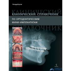 Книга "Клинический справочник по ортодонтическим мини-имплантатам"